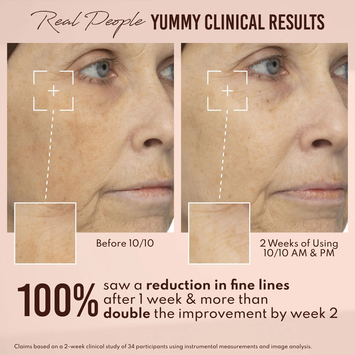 Yummy Skin 10/10 Barrier Boost Hyaluronic Acid + Ectoin Plumping Serum