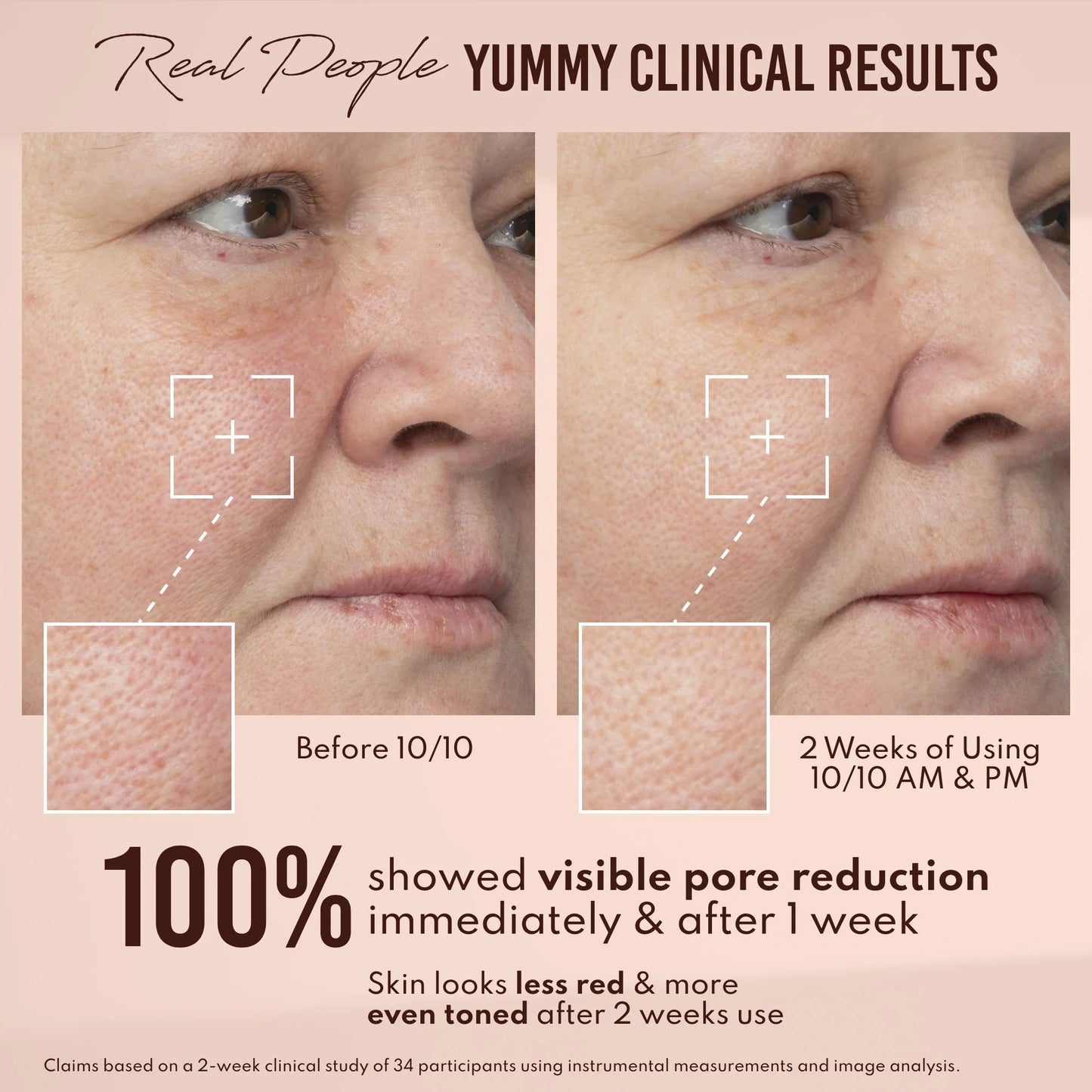 Yummy Skin 10/10 Barrier Boost Hyaluronic Acid + Ectoin Plumping Serum